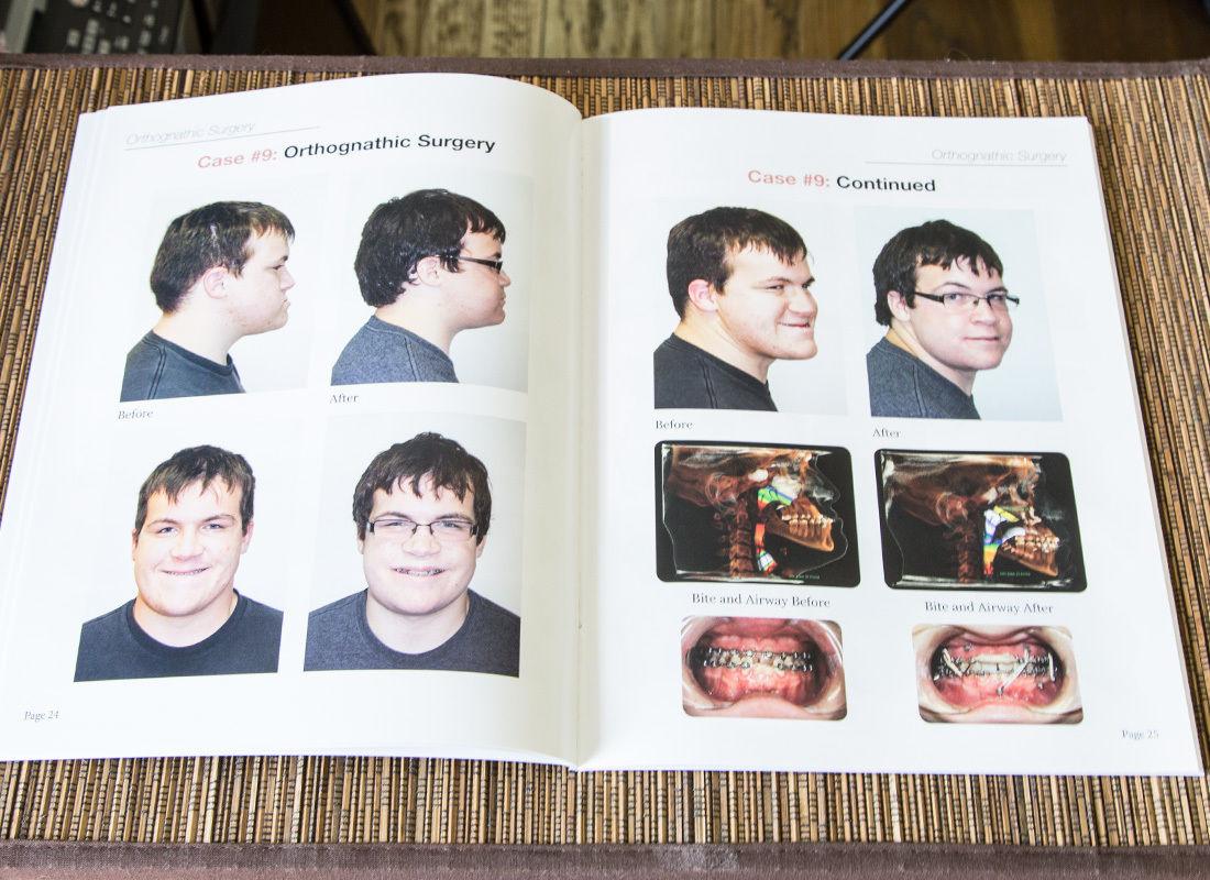 Patient Guide To Corrective #jawsurgery <a href="/aaoms/">AAOMS - Oral and Maxillofacial Surgeons</a> @AAOMSservices @aaomdentistry you can buy here ebay.to/1KHVFLp