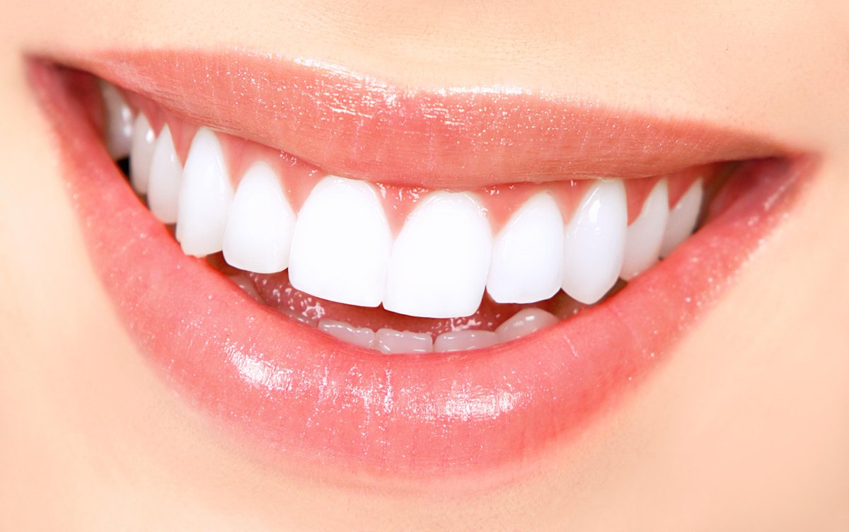#Teeth-in-an-hour - <a href="/Dr_Antipov/">Dr.Alexander Antipov</a> more #information : drantipov.com/dental-implants