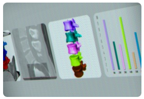 EmilyGi52769653's tweet photo. RT http://t.co/Y9gHTLl3TJ In 3 hours: #openinventor #SDK webinar - #medical image processing #remote rendering #… http://t.co/2riMao8gGN