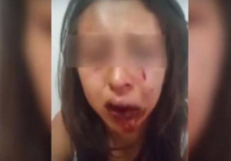 unosantafe's tweet image. [VIDEO] Adolescente #internada tras brutal #golpiza de su #novio. ► bit.ly/1FjaMcv