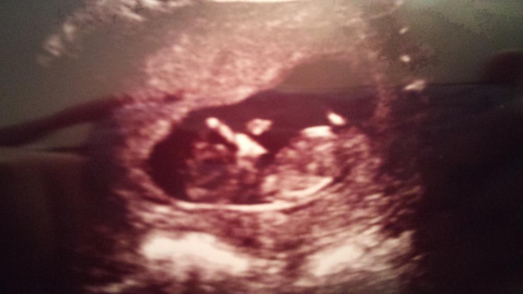 mana013's tweet photo. Hello from Baby Cradic! http://t.co/HhBm2Lwl6r