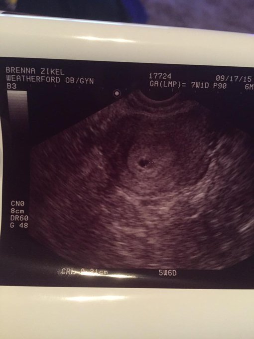🖤🥀Bree Kyle🥀🖤 - Since everyone already know. So beyond blessed 🙏🏼😍💞👶🏼 http://t.co/4OjGehZQUr
