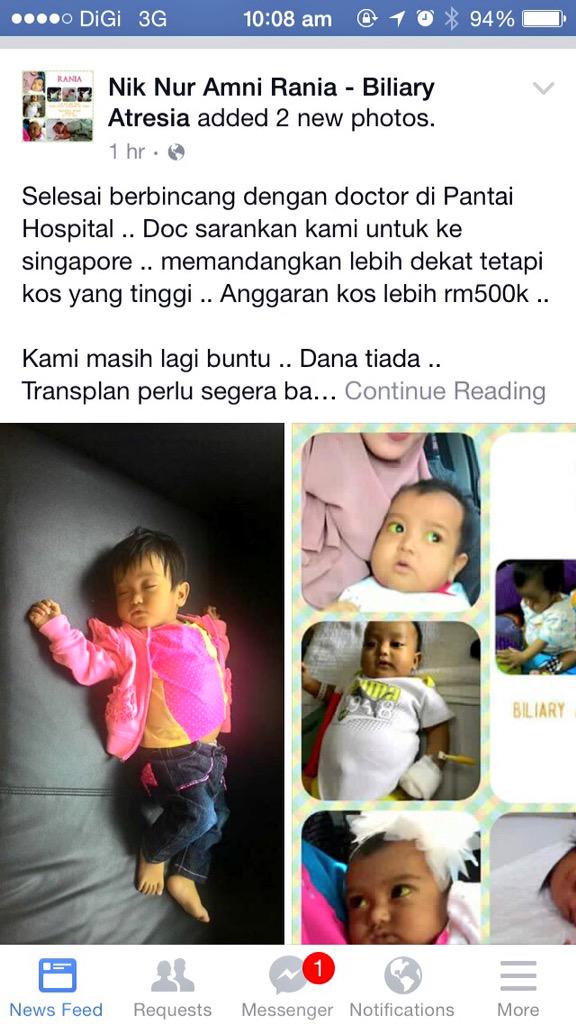 wawaasilah's tweet photo. Awk tolong sy RT pun dah cukup.please help me spread this, rania's mother is my sister's friend,she needs RM500k.🙏🏻😔 http://t.co/vH6VafD5GV