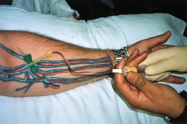 Juha Wahlstedt on X: "Tattoo Your Veins for Blood Draw http://t.co/SzuOHB0oyj #Medlab #Pathology #Phlebotomy #Biomedical #Science http://t.co/cJyLSlUGT6" / X