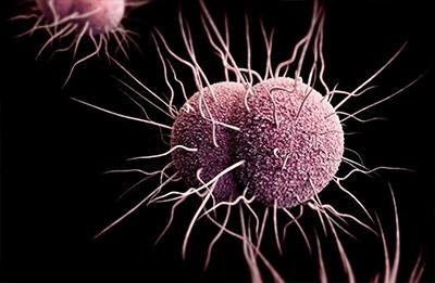 Nash_Newcast's tweet photo. 'Super-gonorrhoea' outbreak in Leeds #UK http://t.co/9x61YGSgxc