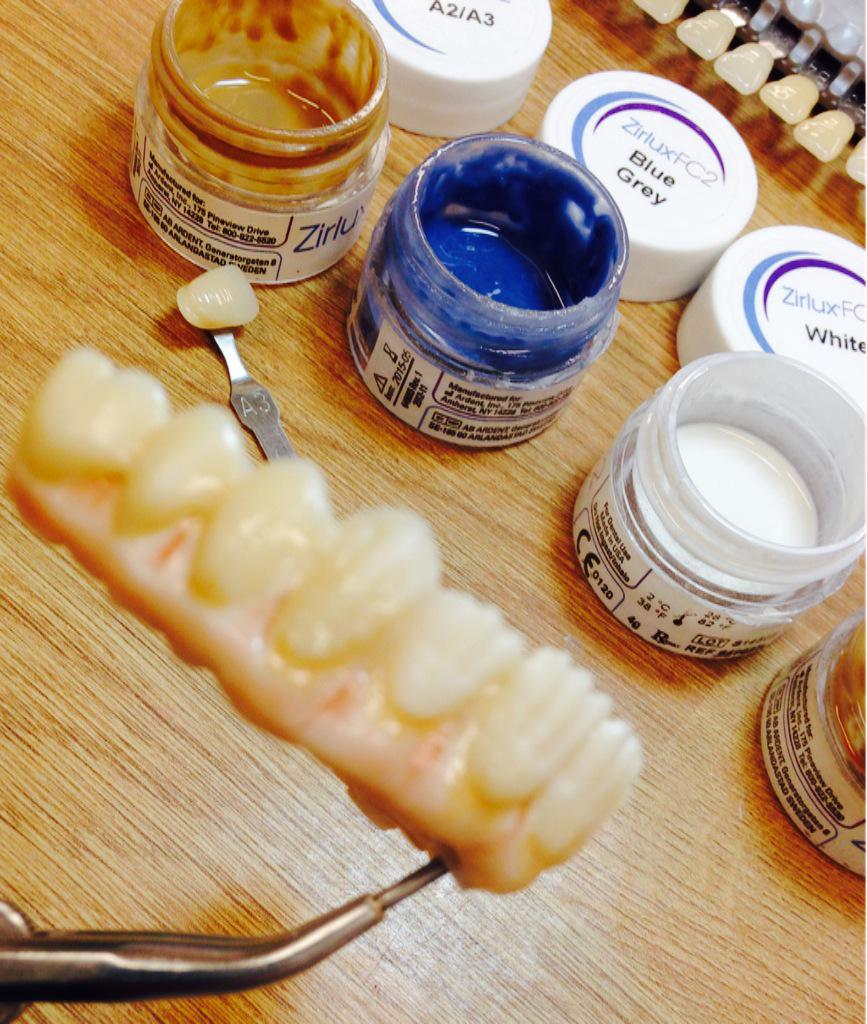 @IvoclarUK e.max Ceram on full Zirlux 3/4 contour bridge. Occlusion &amp; contour designed on Exocad   <a href="/HSDLabUK/">HSDLabUK</a>