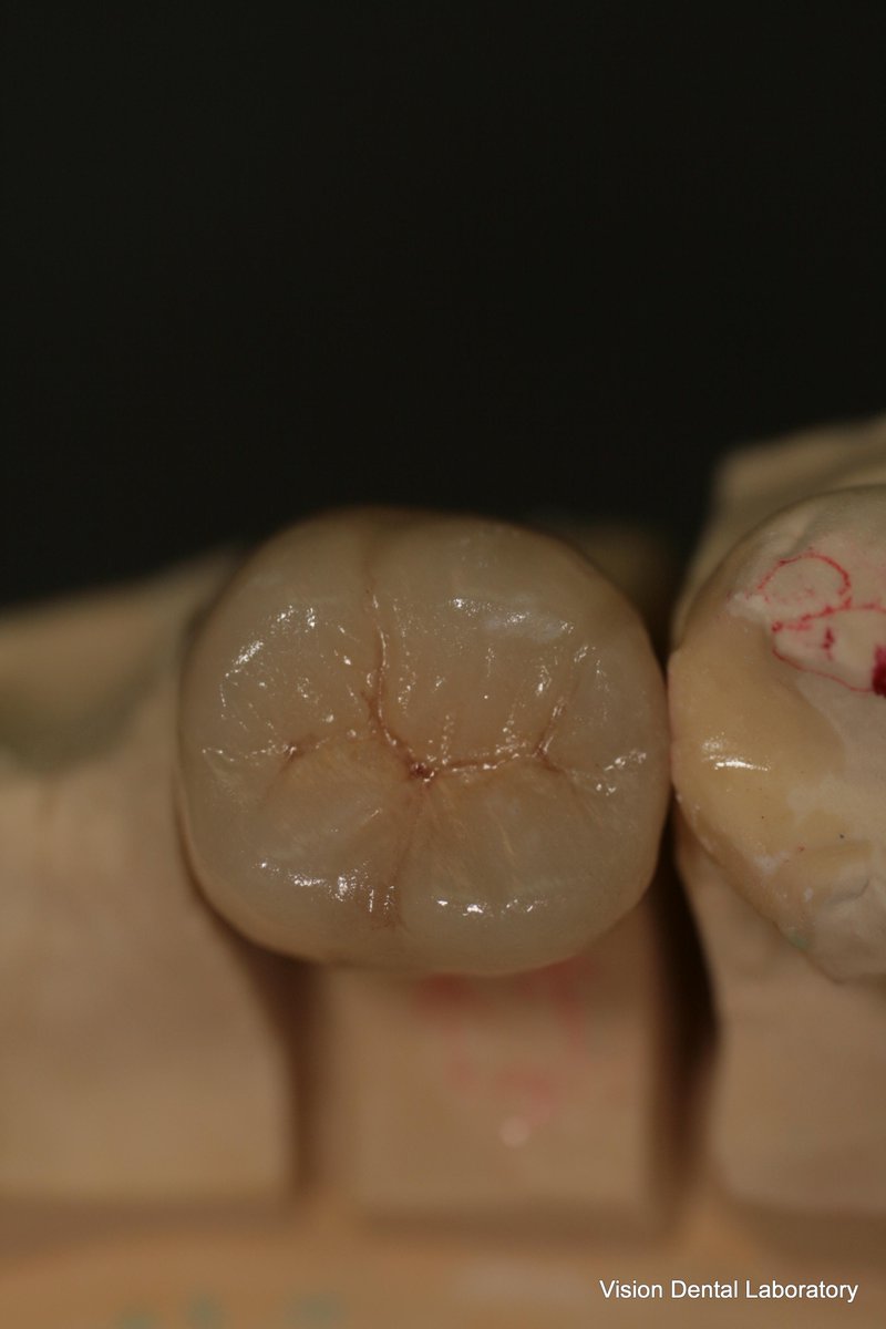 Vision Dental Lab (visiondentalab) Twitter