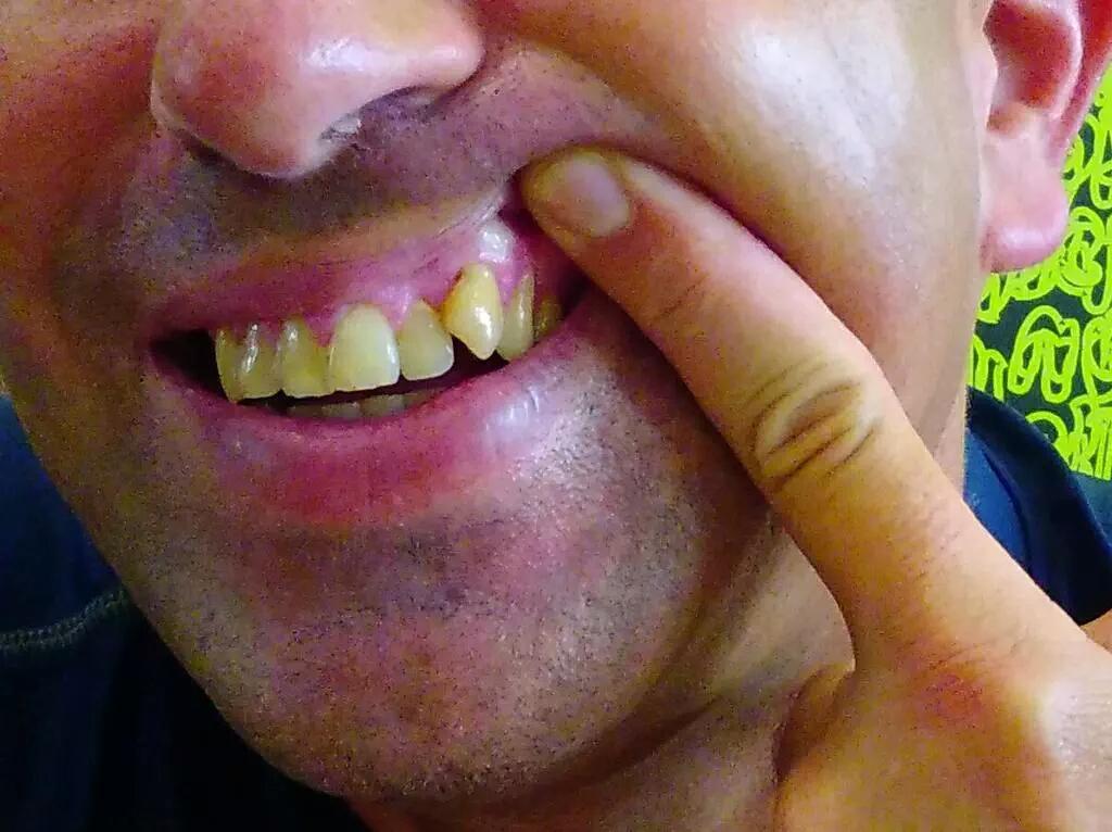 KimisDumbo80's tweet photo. @kanyewest #ReadMyTeeth #GodLovesMetal #GodHatesRap #GodHatesKanye #GodLovesColor #ConYayIsGayay #BlackPeopleSuck DIE http://t.co/GiAf99ljch