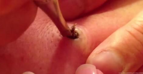 WhatDidlJustSee's tweet photo. A Girl Noticed Something On Her Aunt's Skin, She Never Imagined This Would Come Out.. http://t.co/JlDNjLgsJy http://t.co/IgechIG5g2