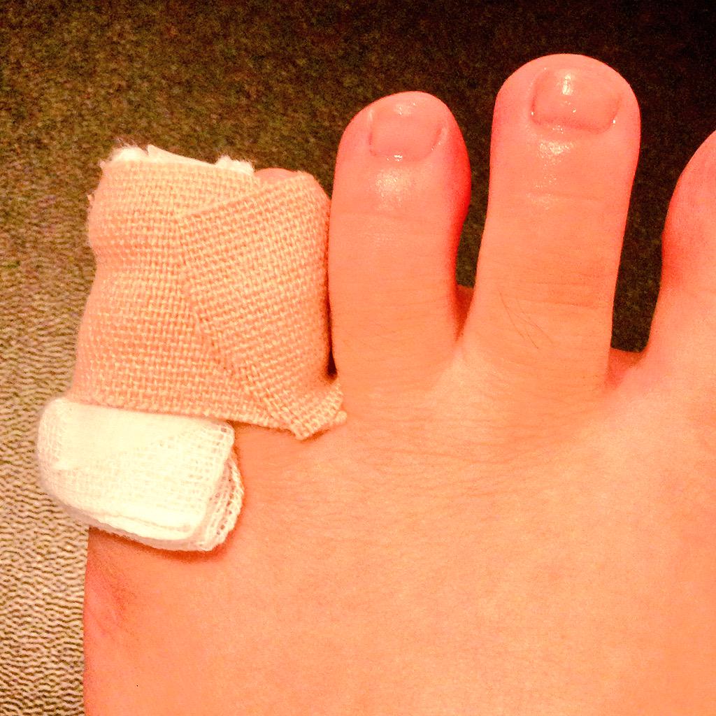 政 Twitterren 初めての骨折 原因は足の小指をテーブルの角にぶつけた事による骨折 見よ これが足の小指をぶつけた時のレベルmaxだ 足の小指をぶつけるの舐めたらいけないぞ O Http T Co Xszoxn9gbv