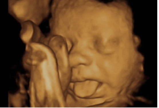 LifeNewsHQ's tweet photo. House Passes Bill to Stop Planned Parenthood Harvesting Aborted Babies Still Alive http://t.co/lEvLAsdLr1 http://t.co/KdMF9W88SD