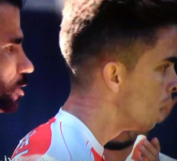 FootballFactly's tweet photo. Scratches on Gabriel's neck... http://t.co/OV4tJGE7t7