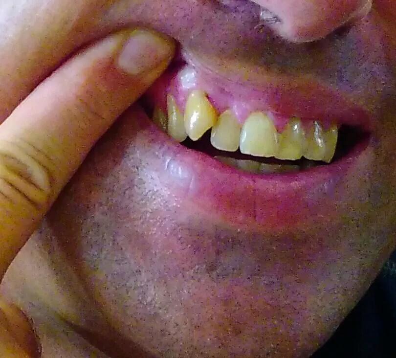 PigDickSucker80's tweet photo. @KimKardashian #Psoriasis #WhenItActsUp #ThinkOfMe #Bitch #Bimbo80 #YouLeftMeSufferingMassivePAIN @robkardashian 6371 http://t.co/smPxZDgZby