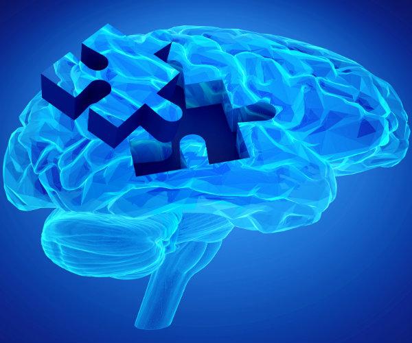 HISC_Overland's tweet image. Could Down Syndrome Hold the Key to an Alzheimer&apos;s Cure? nws.mx/1Qqg5HH #Alzheimers #LookingForACure