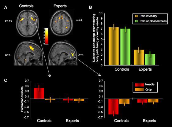 EMtogether's tweet photo. Pain is in the brain of the beholder.

Expertise modulates pain perception in others. 

http://t.co/EAWnLwyuWf #PSOOR http://t.co/Jxe6XS7Xvh