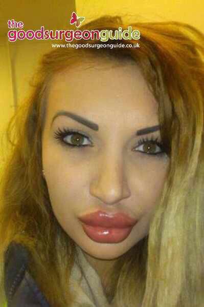 NeweruModels's tweet photo. Imagine if she went in and asked for natural #lip enhancement, Be clear on expectations. #GSGism http://t.co/so6yZnsY3o