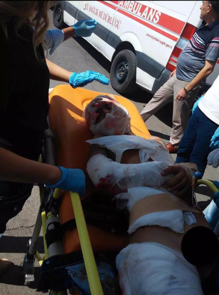 PKK çocuklara saldırmaya devam ediyor. 7 çocuk okulla değil PKK bombasıyla tanıştı.