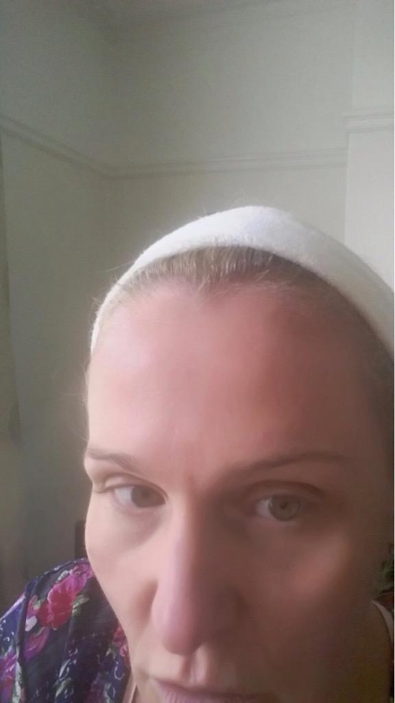 GoodbyeToBotox's tweet photo. This fod has no Botox - I know you don't believe me ! http://t.co/w7SEPvVAEh