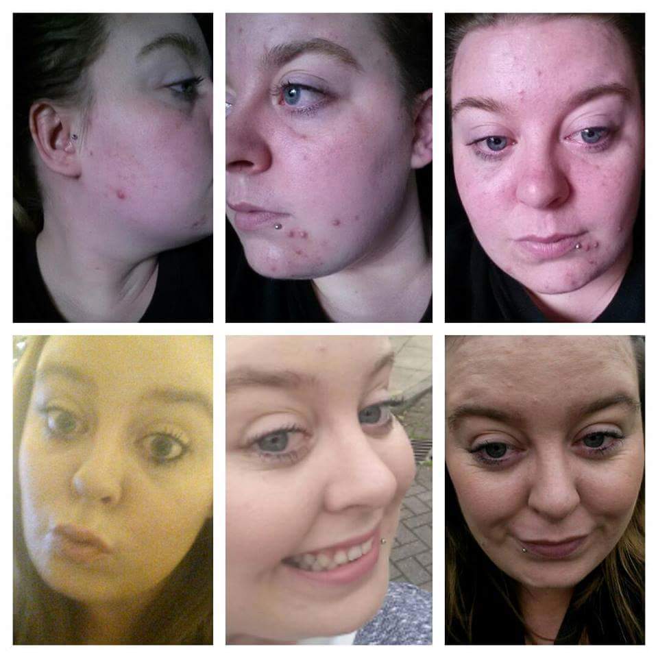 HealthywithHowe's tweet image. Premium Capsules had an amazing effect after just 2 weeks!! PM me to get yours!!!