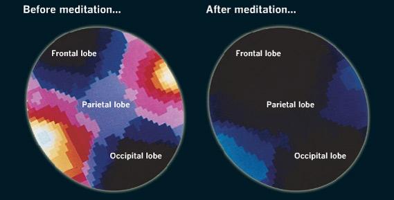 KevinCurtin's tweet photo. This is How Meditation Affects our Brains:  http://t.co/8dESHwZmpp http://t.co/16fYd5mQGF
http://t.co/XsU2o4SqXr http://t.co/Z7Gnem4uEW