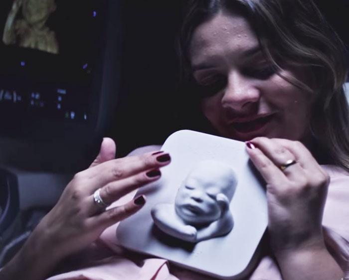 ballhardsam's tweet photo. Blind Pregnant Woman 'Sees' Her Unborn Baby For The First Time With 3D Printing http://t.co/KZeL6ioZsO http://t.co/bXgTWgW0EY