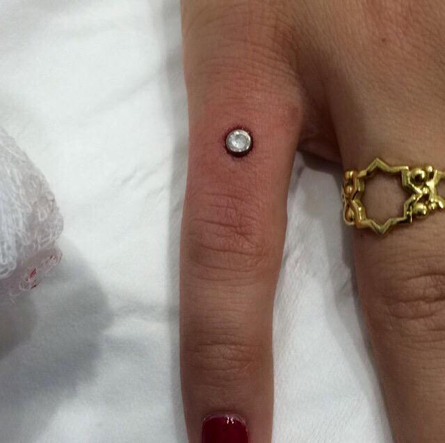 Metalpiercing's tweet image. Fresh pinky dermal by Steve #piercing #dermal #surfaceanchor #topshop #westend #london