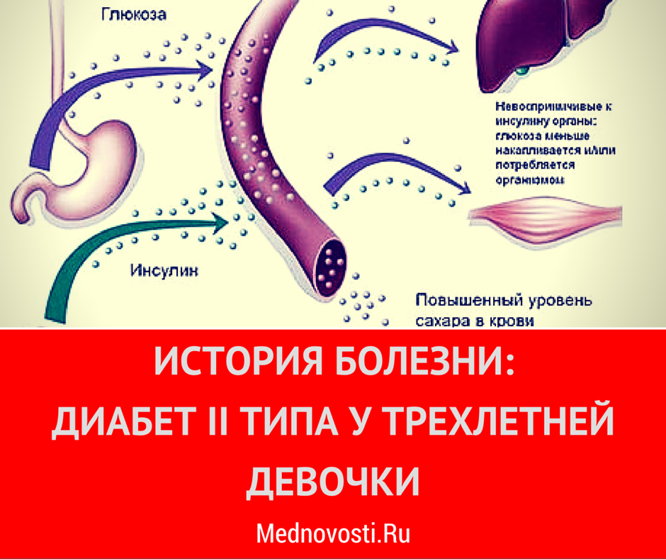 MedNovosti's tweet photo. В копилку необычных случаев → http://t.co/HA6Jxo0vkM http://t.co/XYTeuCvy1Y