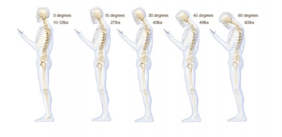 bodyworkthpy's tweet photo. Keep those heads up & away from your phone for long periods. Make your #bodywork #StrengthInTherapy http://t.co/6FtqZefePE