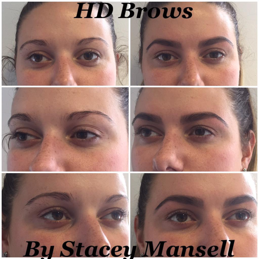 StaceysBrowBar's tweet photo. HD Brows before and after ❤️ http://t.co/qPOxYRc8Yk