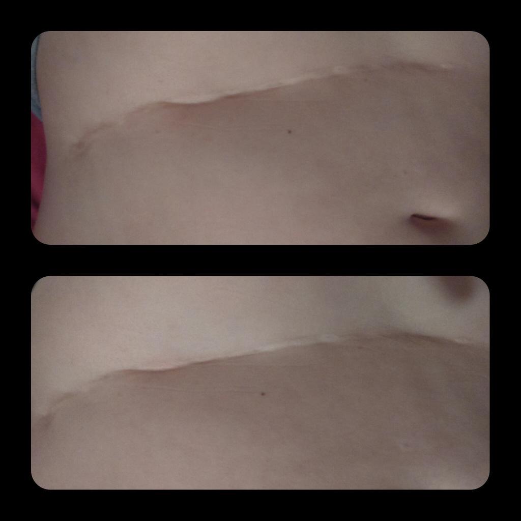 'Bentieee tweet media