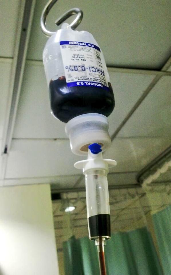 EnfrmraSaturada's tweet photo. Aquí, poniéndole hierro al asunto. http://t.co/cGCQ0AiuLo