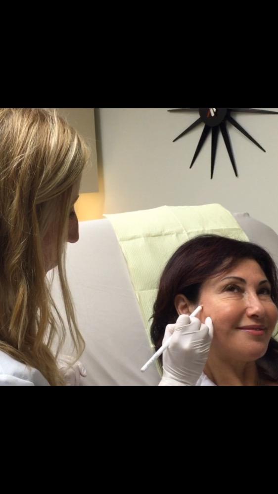 luminaskin's tweet photo. Tatiana loves the #instantvolume #Juvederm #Voluma gives her cheeks! #defygravity #allergan #LuminaSkin #sanmateo http://t.co/J3PcMyM3ze