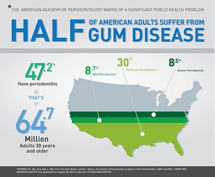 PdxDentistry's tweet photo. Periodontal disease affects 50% of Americans over the age of 30 &amp; 70% over the age of 75. #oralsystemicconnection http://t.co/EJ6nyRMMJ0