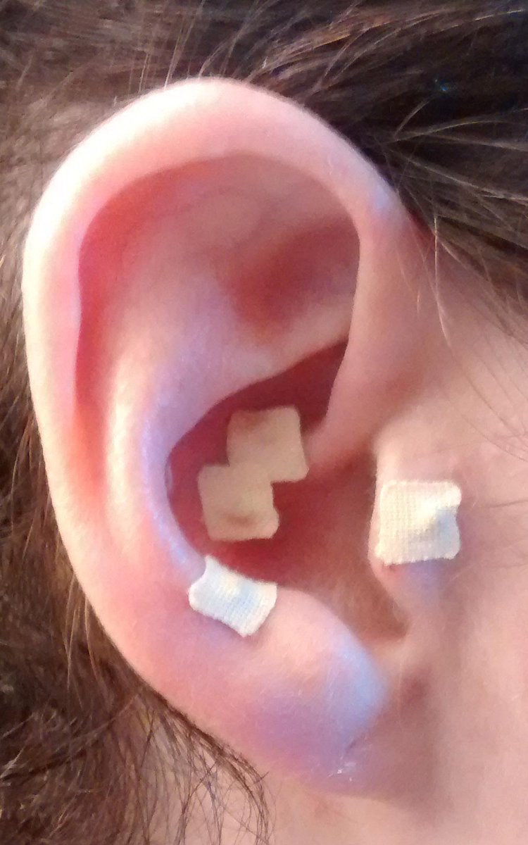 AcuThriveLLC's tweet photo. Let the #product beta testing begin! Would you ever beta test a new #earseed product for #weightloss or #depression? http://t.co/gx63fwoyzn