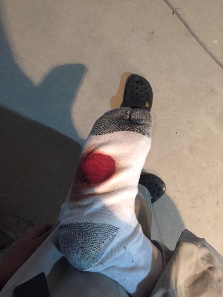 yudai24865's tweet photo. ビス踏んだクソ痛い
指カッターで切ったクソ痛い http://t.co/krMDTJXBKR