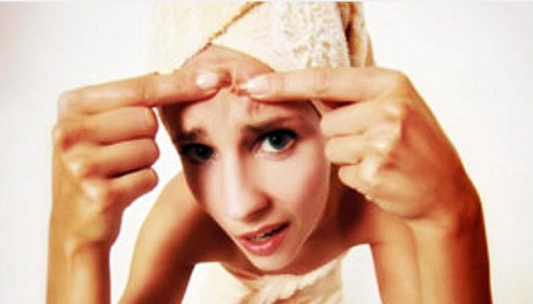 martial_artsuk's tweet photo. parentbuzzz: TheZenParent: Help your #teens to get rid of #pimples #naturally #parenting #zenparent #acne #mblogge… http://t.co/sbqNLI7eRW