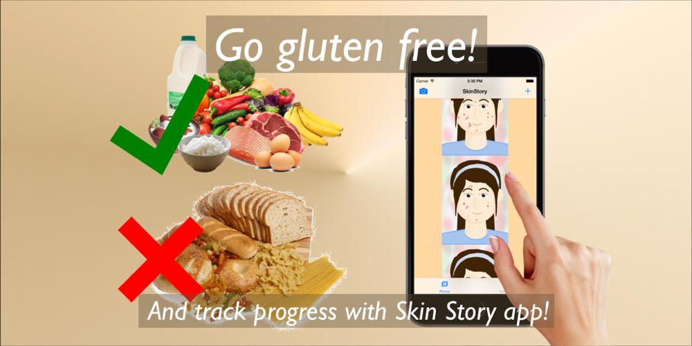 SkinStoryApp's tweet photo. If you decide to go #glutenfree, make sure you track your #acne progress with the #SkinStory app! #skincare http://t.co/GTW85OYI2S