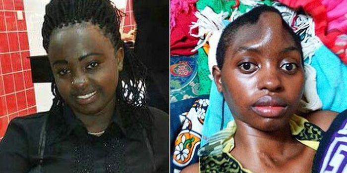 Kenyans's tweet photo. Woman to Get Reconstructive Surgery From Skull in Stomach http://t.co/pgvq1kkJ4f #WhyWaitToRealize http://t.co/9I6XLpkqLc