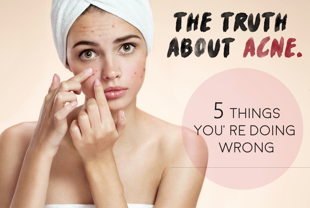 trade_w_insight's tweet photo. 5 Things You Might Be Doing to Cause Acne! http://t.co/wr7L92Cli0 #dermcheck http://t.co/pluTdXSFZb