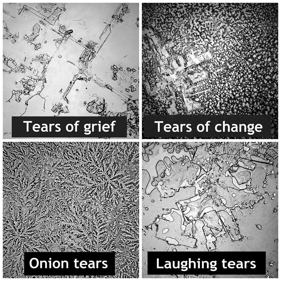 Bellco_Glass's tweet photo. RT @SantaCruzBio: Chemical differences in our tears? You bet! http://t.co/M6BkfffxkF #lifeinthelab #microscopy http://t.co/o4UnUGJXJO