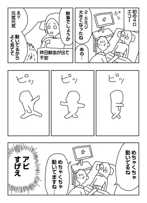 【漫画】4Dエコー 