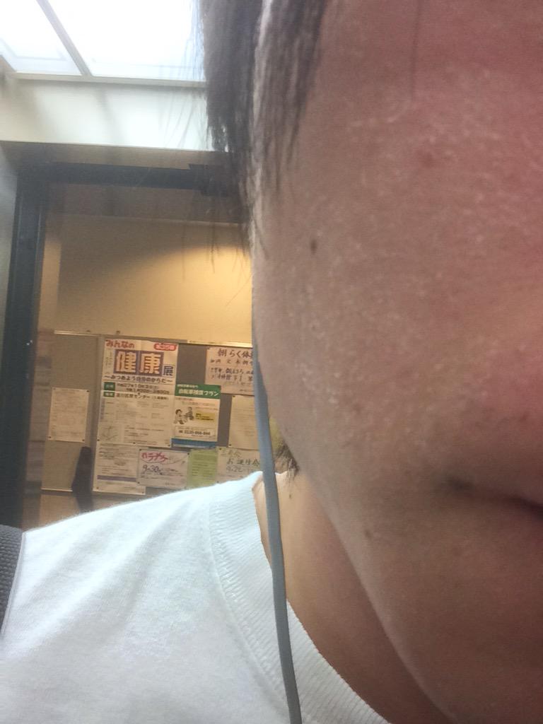 りょん Di Twitter 富士山の爪痕 日焼け 肌カサカサ Twinboxfujisan15 Http T Co Mkpsrstuge Twitter