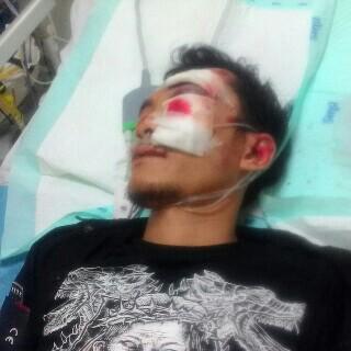 Turut brduka atas musibah yg mnipa bang azis dapur smoga cpet smbuh dn di mudahkn sgalanya آمــين اَللّهُمَّ آمــين