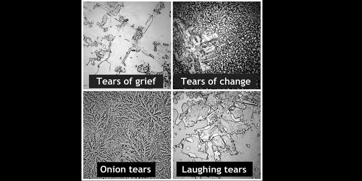 Bellco_Glass's tweet photo. RT @SantaCruzBio: Chemical differences in our tears? You bet! http://t.co/M6BkfffxkF #lifeinthelab #microscopy http://t.co/o4UnUGJXJO