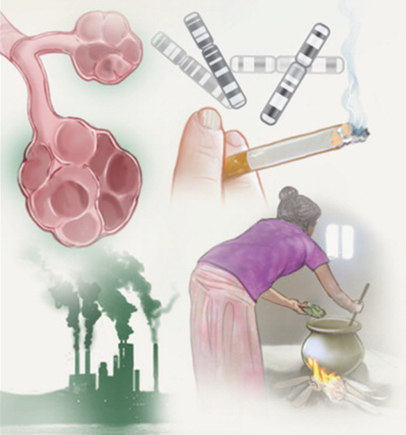 NEJM's tweet photo. Review Article: Asthma–COPD Overlap Syndrome. http://t.co/VzmmbFP5EE http://t.co/1aLxw1MIOG