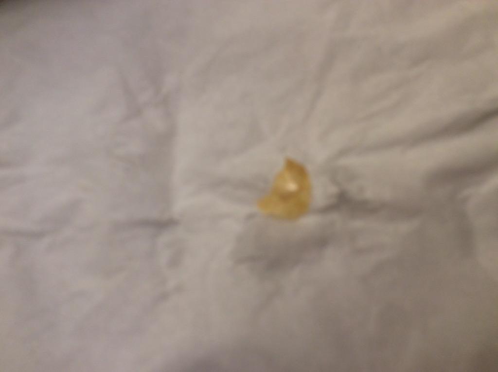 SoraBullys's tweet image. Bed Bug-fingernail in bed and filth at the Clarion Batavia NY-DISGUSTING HOTEL