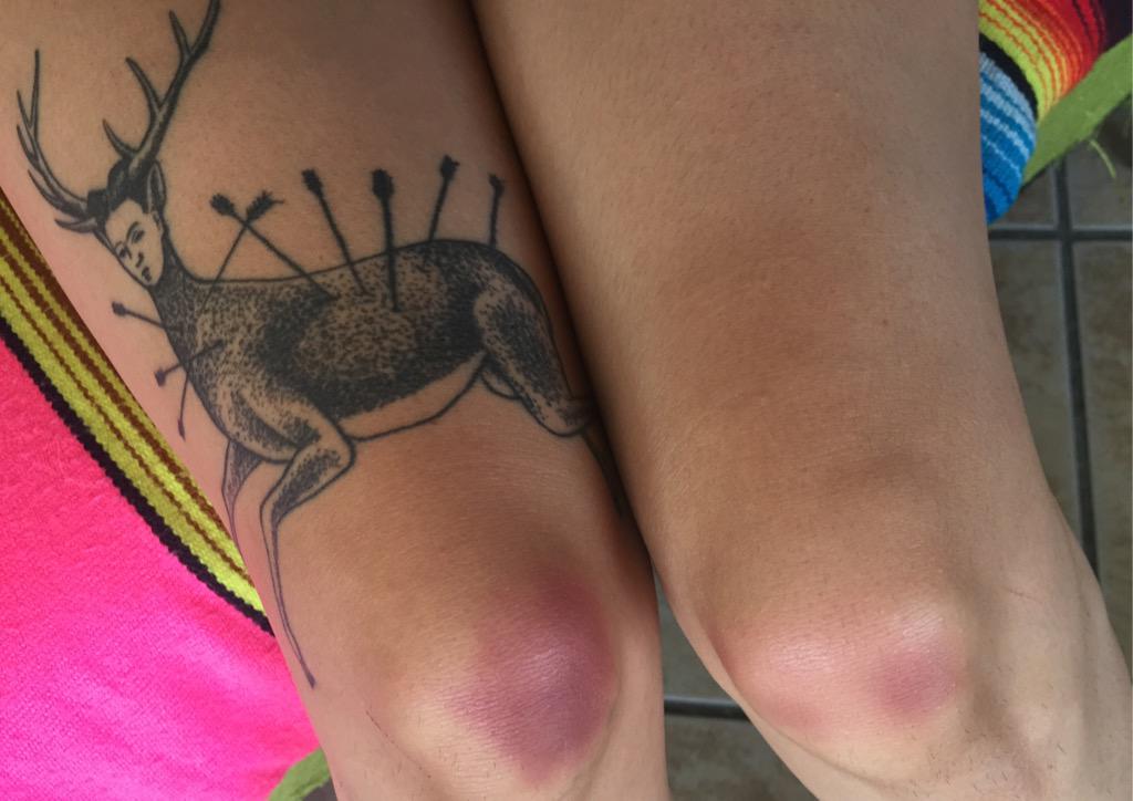 THINK_HARDER_'s tweet photo. I was hoping for more pleasure cuts from last nights @IAMX gig but I'm proud of my battle wounds #DanceYaAssOff http://t.co/vswGTTXuC3
