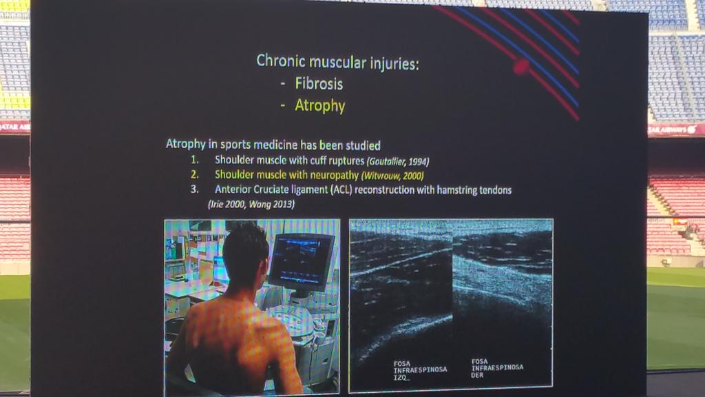 carlespedret's tweet image. Chronic muscle injuries: atrophy #MTNECOSEP