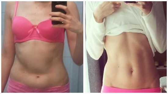 BeFitHeaIthy's tweet photo. Doctors reveal rapid weight loss trick 
✅Flat stomach
✅Toned thighs
✅Tight waist
All from👉http://t.co/OhDZ2IYBFW http://t.co/ckevyA1Qnt
