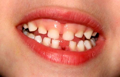 ACEDrecover's tweet photo. #MadeUsHappy
1 First #toothfairy visit
2 Trying to slide $2 under pillow
3 But not waking child
#FindTheBeauty http://t.co/go3yoAQyoN